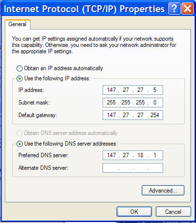 Windows XP TCP/IP